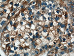 LRG1 Antibody in Immunohistochemistry (Paraffin) (IHC (P))