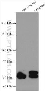 RCBTB2 Antibody in Western Blot (WB)