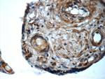 ARSB Antibody in Immunohistochemistry (Paraffin) (IHC (P))