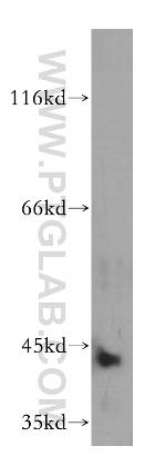 ARSB Antibody in Western Blot (WB)