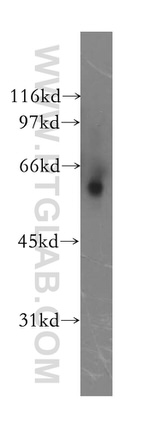 Alpha-2-antiplasmin Antibody in Western Blot (WB)