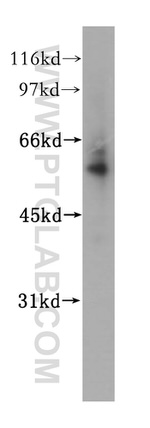 Alpha-2-antiplasmin Antibody in Western Blot (WB)