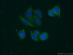 Alpha-2-antiplasmin Antibody in Immunocytochemistry (ICC/IF)