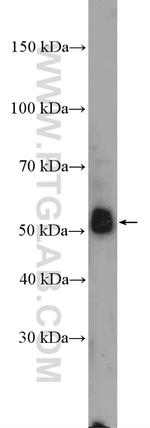 Alpha-2-antiplasmin Antibody in Western Blot (WB)