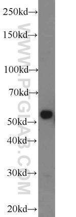 CYP1A1 Antibody in Western Blot (WB)