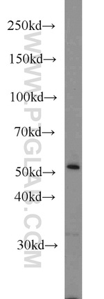 CYP1A1 Antibody in Western Blot (WB)