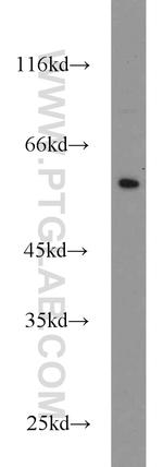 CYP4F12 Antibody in Western Blot (WB)