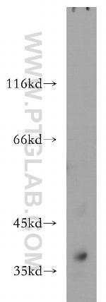 ASPA Antibody in Western Blot (WB)