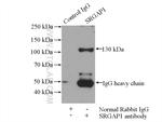 SRGAP1 Antibody in Immunoprecipitation (IP)