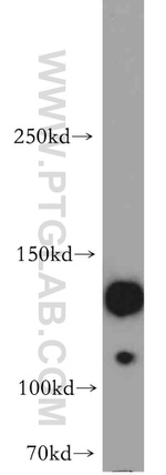 SRGAP1 Antibody in Western Blot (WB)