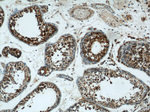 SPPL2A Antibody in Immunohistochemistry (Paraffin) (IHC (P))