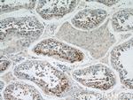 SPPL2A Antibody in Immunohistochemistry (Paraffin) (IHC (P))