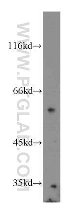 SPPL2A Antibody in Western Blot (WB)