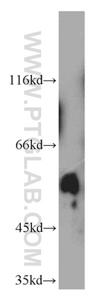 SPPL2A Antibody in Western Blot (WB)