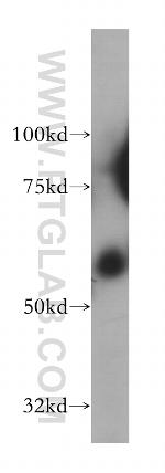 SPPL2A Antibody in Western Blot (WB)