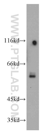 SPPL2A Antibody in Western Blot (WB)