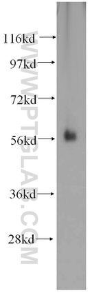 SPPL2A Antibody in Western Blot (WB)