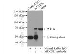 MLXIPL Antibody in Immunoprecipitation (IP)