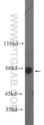 MLXIPL Antibody in Western Blot (WB)