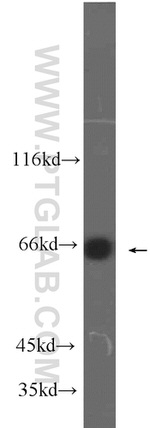 MLXIPL Antibody in Western Blot (WB)