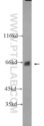 MLXIPL Antibody in Western Blot (WB)