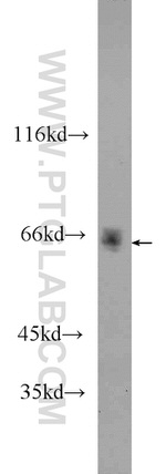 MLXIPL Antibody in Western Blot (WB)