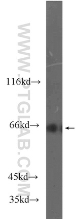 MLXIPL Antibody in Western Blot (WB)