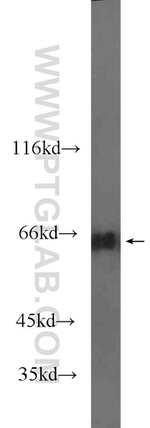 MLXIPL Antibody in Western Blot (WB)