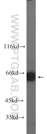 MLXIPL Antibody in Western Blot (WB)