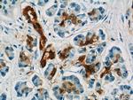 Gamma adaptin Antibody in Immunohistochemistry (Paraffin) (IHC (P))