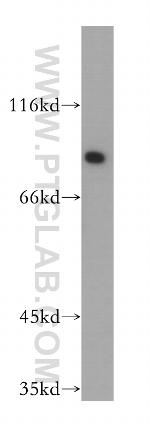 Gamma adaptin Antibody in Western Blot (WB)