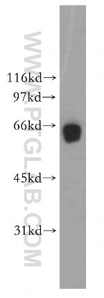 CaMKIV Antibody in Western Blot (WB)