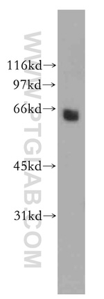 CaMKIV Antibody in Western Blot (WB)