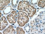 GGH Antibody in Immunohistochemistry (Paraffin) (IHC (P))