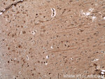 NGEF Antibody in Immunohistochemistry (Paraffin) (IHC (P))