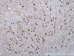 NGEF Antibody in Immunohistochemistry (Paraffin) (IHC (P))