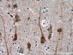 NGEF Antibody in Immunohistochemistry (Paraffin) (IHC (P))