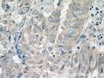 CPEB1 Antibody in Immunohistochemistry (Paraffin) (IHC (P))