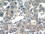 CPEB1 Antibody in Immunohistochemistry (Paraffin) (IHC (P))