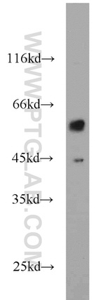 CPEB1 Antibody in Western Blot (WB)