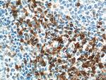 TRAT1 Antibody in Immunohistochemistry (Paraffin) (IHC (P))