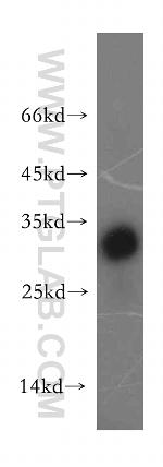 TRAT1 Antibody in Western Blot (WB)