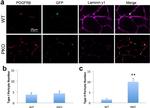 CD140b (PDGFRB) Antibody in Immunohistochemistry (IHC)