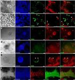 Chromogranin A Antibody in Immunocytochemistry (ICC/IF)