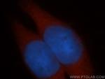 ADH6 Antibody in Immunocytochemistry (ICC/IF)