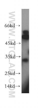 RDH12 Antibody in Western Blot (WB)