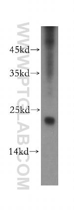 RNF125 Antibody in Western Blot (WB)
