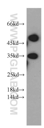 Syntaxin 11 Antibody in Western Blot (WB)