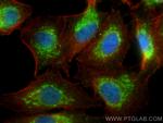 VASH2 Antibody in Immunocytochemistry (ICC/IF)