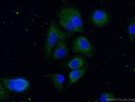 VASH2 Antibody in Immunocytochemistry (ICC/IF)